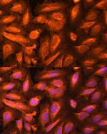 DTYMK Polyclonal Antibody