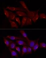 GRP Polyclonal Antibody