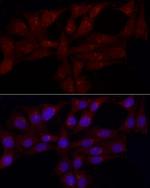 GRP Antibody in Immunocytochemistry (ICC/IF)