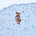 GRP Antibody in Immunohistochemistry (Paraffin) (IHC (P))