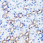 IMPA1 Antibody in Immunohistochemistry (Paraffin) (IHC (P))