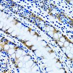 IMPA1 Antibody in Immunohistochemistry (Paraffin) (IHC (P))
