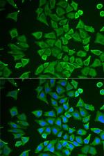 DDAH2 Polyclonal Antibody