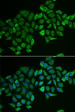 RhoD Polyclonal Antibody