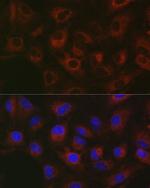 GPLD1 Antibody in Immunocytochemistry (ICC/IF)