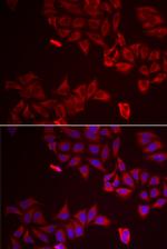 Galectin 8 Antibody in Immunocytochemistry (ICC/IF)