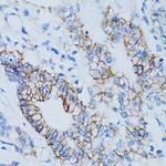 Galectin 8 Antibody in Immunohistochemistry (Paraffin) (IHC (P))
