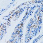 Galectin 8 Antibody in Immunohistochemistry (Paraffin) (IHC (P))