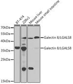 Galectin 8 Antibody in Western Blot (WB)