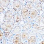 Monoacylglycerol Lipase Polyclonal Antibody