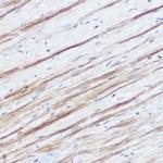 Monoacylglycerol Lipase Antibody in Immunohistochemistry (Paraffin) (IHC (P))
