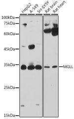 Monoacylglycerol Lipase Antibody in Western Blot (WB)