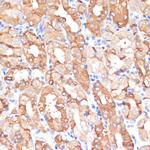 NHLRC1 Polyclonal Antibody