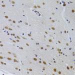 PPP1R8 Antibody in Immunohistochemistry (Paraffin) (IHC (P))