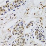 PPP1R8 Antibody in Immunohistochemistry (Paraffin) (IHC (P))