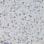 PPP1R8 Antibody in Immunohistochemistry (Paraffin) (IHC (P))
