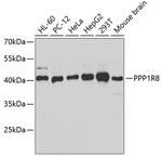 PPP1R8 Antibody in Western Blot (WB)