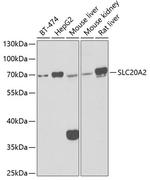 SLC20A2 Polyclonal Antibody