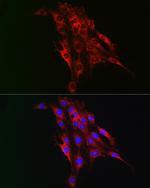 TAGLN2 Polyclonal Antibody