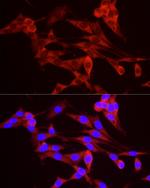 TREX1 Polyclonal Antibody