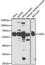 YARS Polyclonal Antibody
