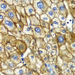 ASGR1 Antibody in Immunohistochemistry (Paraffin) (IHC (P))