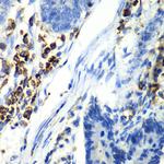 ASGR1 Polyclonal Antibody
