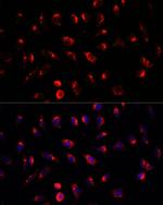 GALNT2 Antibody in Immunocytochemistry (ICC/IF)