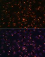 GALNT2 Polyclonal Antibody