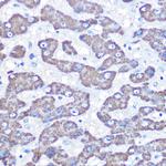 GOT2 Antibody in Immunohistochemistry (Paraffin) (IHC (P))