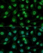 hnRNP M Antibody in Immunocytochemistry (ICC/IF)
