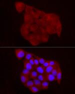 Chemerin Polyclonal Antibody