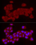 Chemerin Antibody in Immunocytochemistry (ICC/IF)