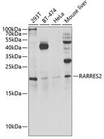 Chemerin Antibody in Western Blot (WB)