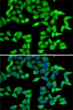 RBBP5 Polyclonal Antibody