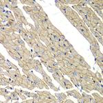 SGCD Polyclonal Antibody