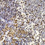 HIRIP3 Antibody in Immunohistochemistry (Paraffin) (IHC (P))