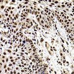 HIRIP3 Antibody in Immunohistochemistry (Paraffin) (IHC (P))