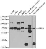HIRIP3 Antibody in Western Blot (WB)