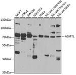 ASMTL Polyclonal Antibody