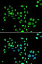 Histone Macro-H2A.1 Polyclonal Antibody