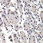 Histone Macro-H2A.1 Antibody in Immunohistochemistry (Paraffin) (IHC (P))