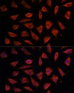 STAM2 Antibody in Immunocytochemistry (ICC/IF)