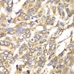 VTI1B Polyclonal Antibody