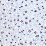 APIP Polyclonal Antibody