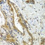 APC6 Antibody in Immunohistochemistry (Paraffin) (IHC (P))
