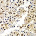 HnRNP Q Polyclonal Antibody