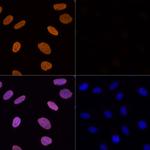 H3K56ac Antibody in Immunocytochemistry (ICC/IF)