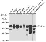 CK1 gamma-2 Polyclonal Antibody