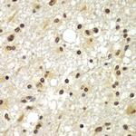 ZNF20 Antibody in Immunohistochemistry (Paraffin) (IHC (P))